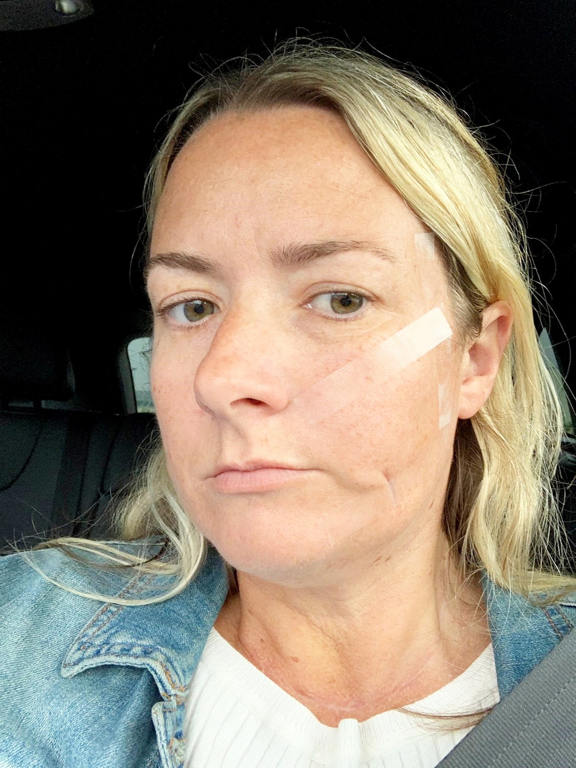 Lisa roky bojovala so zákernou chorobou.