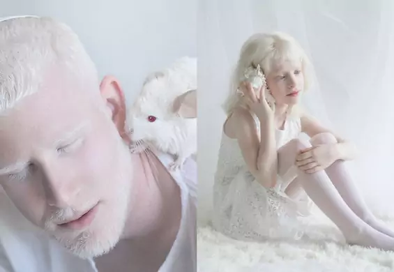 Albinosi - "porcelanowe, hipnotyzujące piękno" uchwycone na zdjęciach