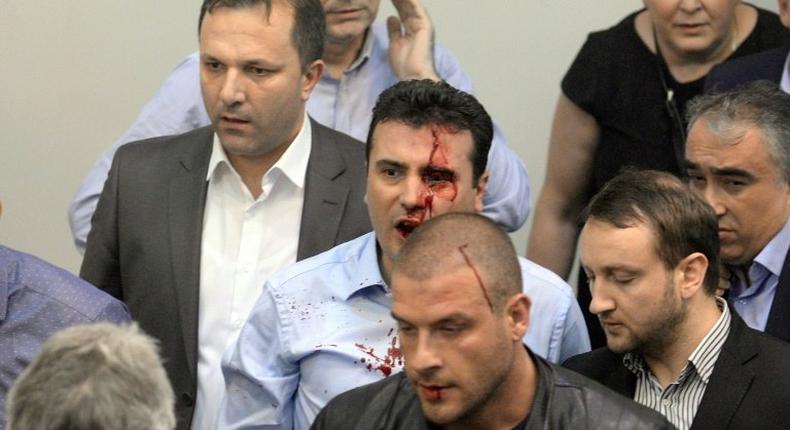 Opposition Social Democrats leader Zoran Zaev bleeds after being injured when supporters of former leading party VMRO-DPMNE entered the parliament following an allegedly unfair vote for a parliamentary speaker in Skopje on April 27, 2017