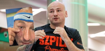 Artur Szpilka ucierpiał podczas sparingu. Skutki dalej widać. "Masakra"