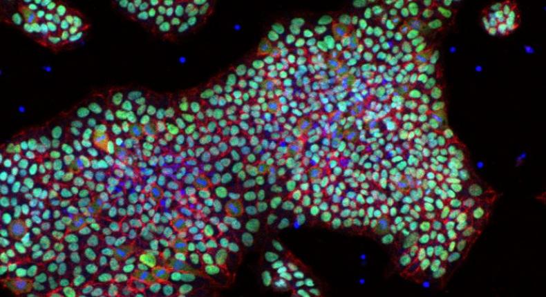 An image of human pluripotent stan cells in IαI media.