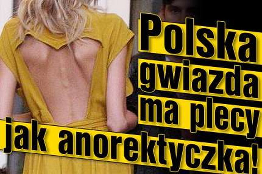 Polska gwiazda ma plecy jak anorektyczka!