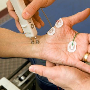 Mi az elektromos stimuláció (elektroterápia)?