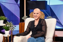 Sonja je najlepša devojka BEZ KOSE koju ste ikada videli! Živi svoju ISTINU BEZ PERIKE, a sada nam je svima poslala VAŽNU PORUKU