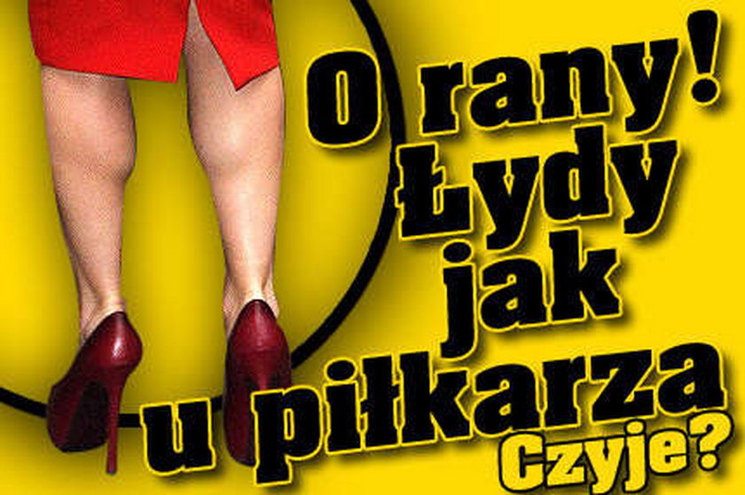 O rany! Łydy jak u piłkarza. Czyje?