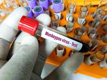 Majomhimlő: ezért azonosíthattak egyszerre sok helyen fertőzötteket