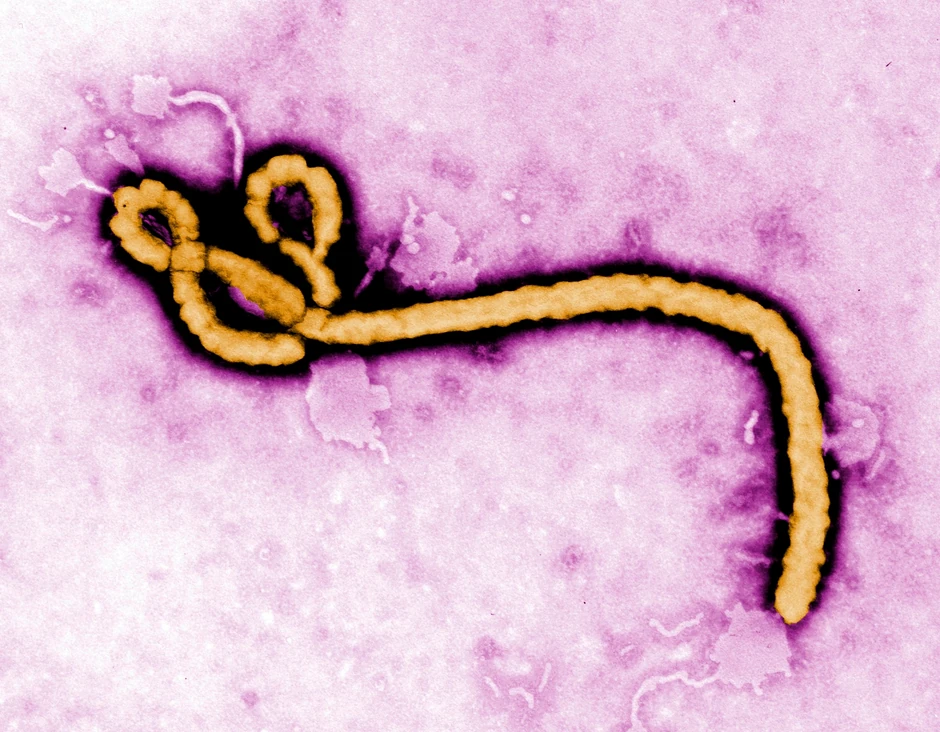Virus ebole