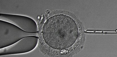 Jest pierwsza ciąża z rządowego in vitro