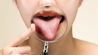 A nyelvrák első jelei, amiket szinte mindenki félreért című cikk nyitóképe