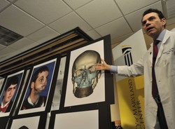 Dostał nową twarz. Takiego przeszczepu jeszcze nie było!