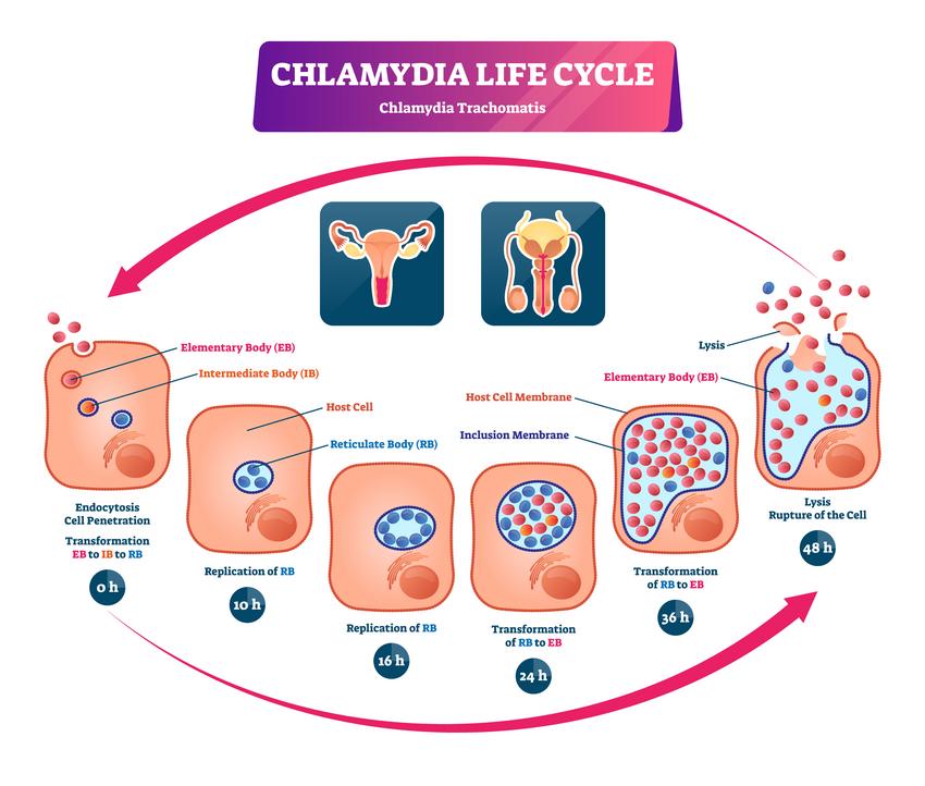 chlamydia ízületi fájdalom)