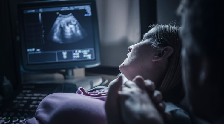 A kismama elment ultrahangra, nem fogod elhinni, hogy mit látott a felvételen Fotó: Getty Images