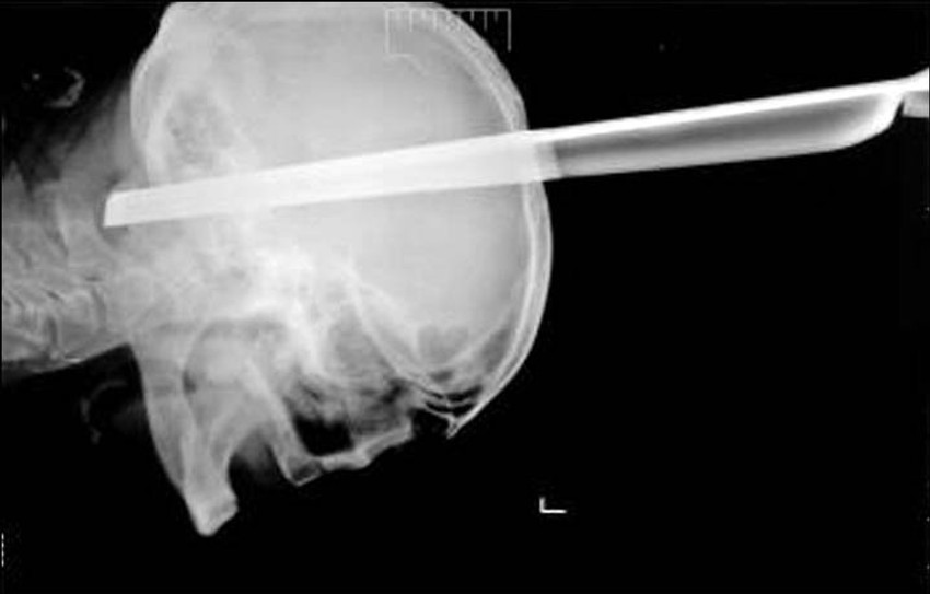 Stravična nesreća koja pukim čudom nije dovela do tragičnih posledica