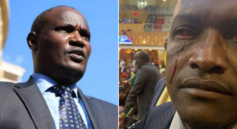 National Assembly Minority Leader John Mbadi and an injured Sigowet-Soin MP Benard Koros