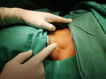 Bőr alatti csomók: nem csak rákot jelezhetnek, ennyiféle oka lehet