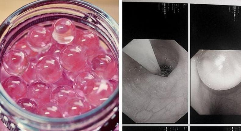 Mum warns of danger after toddler ends up in hospital for swallowing water beads