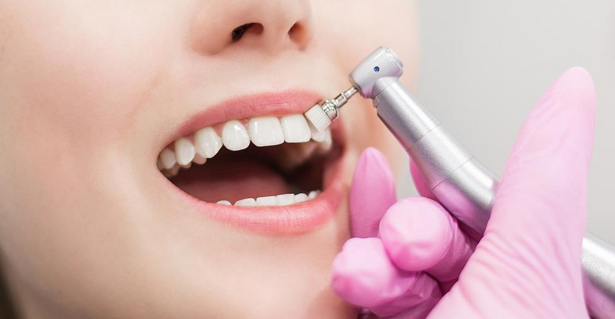 Polerowanie zębów – na czym polega i jakie przynosi korzyści?