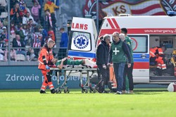 Boli od samego patrzenia. Tak wygląda złamana noga piłkarza Radomiaka [FOTO]