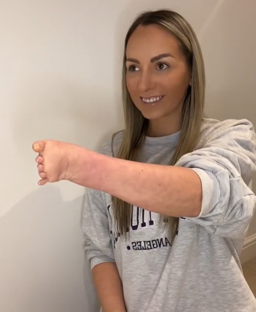 Na sociálnych sieťach zdieľa videá, aby povzbudila ostatných, aby boli sami sebou.