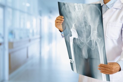Csípőprotézis műtét után így lehet lerövidíteni a gyógyulási időt