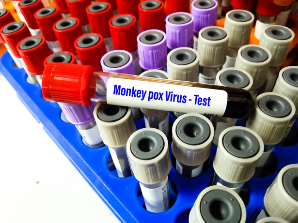 Małpia ospa wirus test