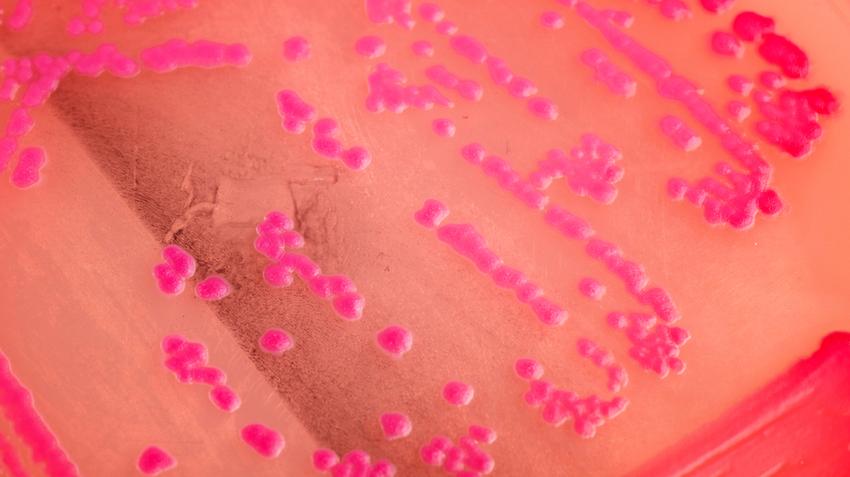 fertőző baktérium Helicobacter pylori nyombélfekély tünete sok sav gyomorrák