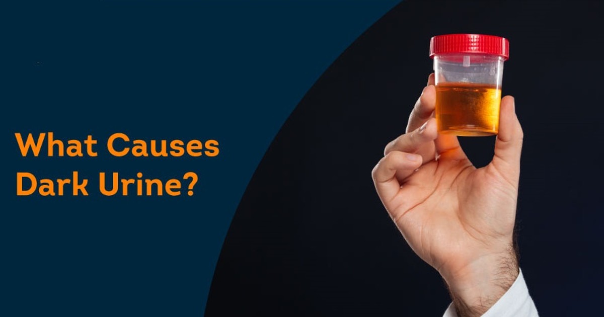 Here's why your urine looks darker in the morning Pulse Ghana