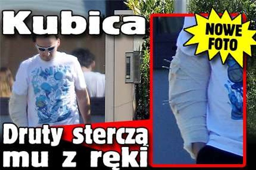 Kubica. Druty sterczą mu z ręki. Nowe zdjęcia