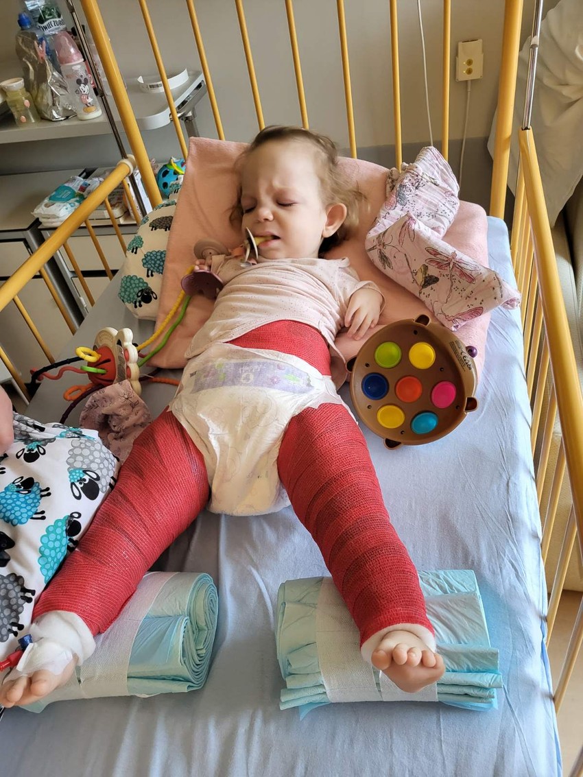 Tri operacije, gips šest nedelja i sada ortoze za jedan maleni korak