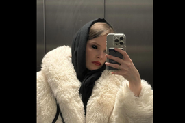 Imala je samo 18 godina kada je dečko UPUCAO U GLAVU: Metak joj razmrskao lobanju, ali se čudom zaustavio na 3 MILIMETRA OD MOZGA