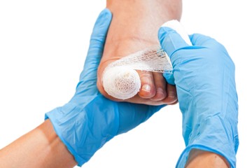 A benőtt köröm népbetegség, ez az egyik leggyakoribb ambuláns (járó beteg) műtét. A betegek rendszerint a körömszél fájdalmas duzzanatáról, vadhús képződéséről, a köröm alóli gennycsorgásról számolnak be.