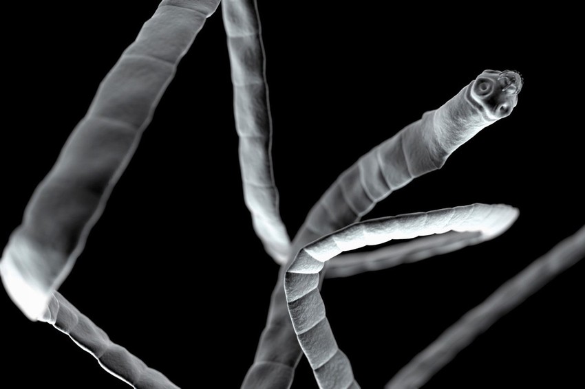 Pantljičara je parazit koji može biti dug i nekoliko metara