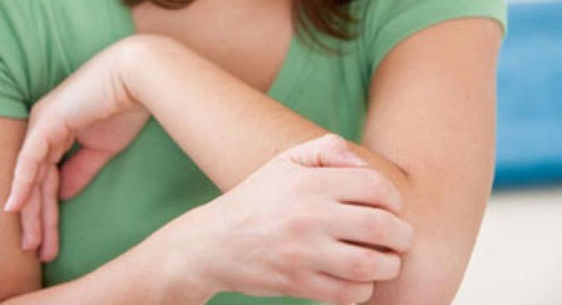 File photo: Woman with itchy skin