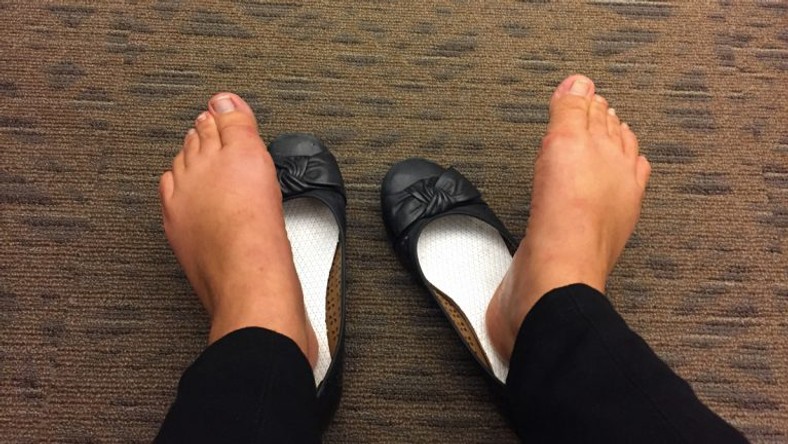 feet stink in sandals