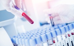 Pierwszy pacjent wyleczony z Covid-19 dzięki osoczu ozdrowieńca