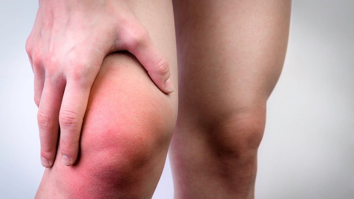 Odmor kolena je ključan u ranim fazama lečenja vode u kolenu 