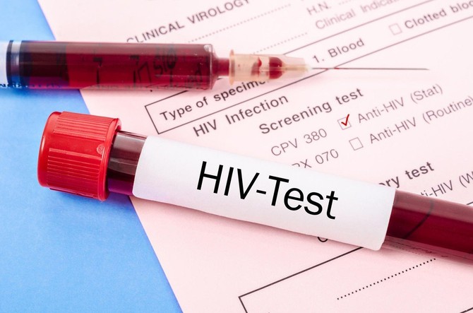 Na svaku otkrivenu HIV infekciju ide bar jedna neotkrivena