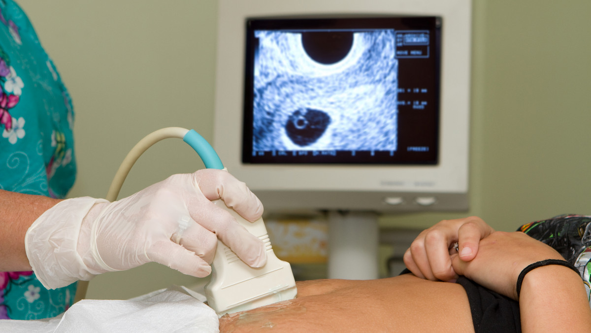 Tak wygląda aborcja w polskich szpitalach. Jest bezpieczna, a kobiecie przysługuje znieczulenie