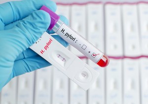 Test krvi na helikobakteriju nije najpouzdaniji