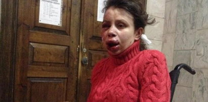 Brutalnie pobito dziennikarkę na Ukrainie!