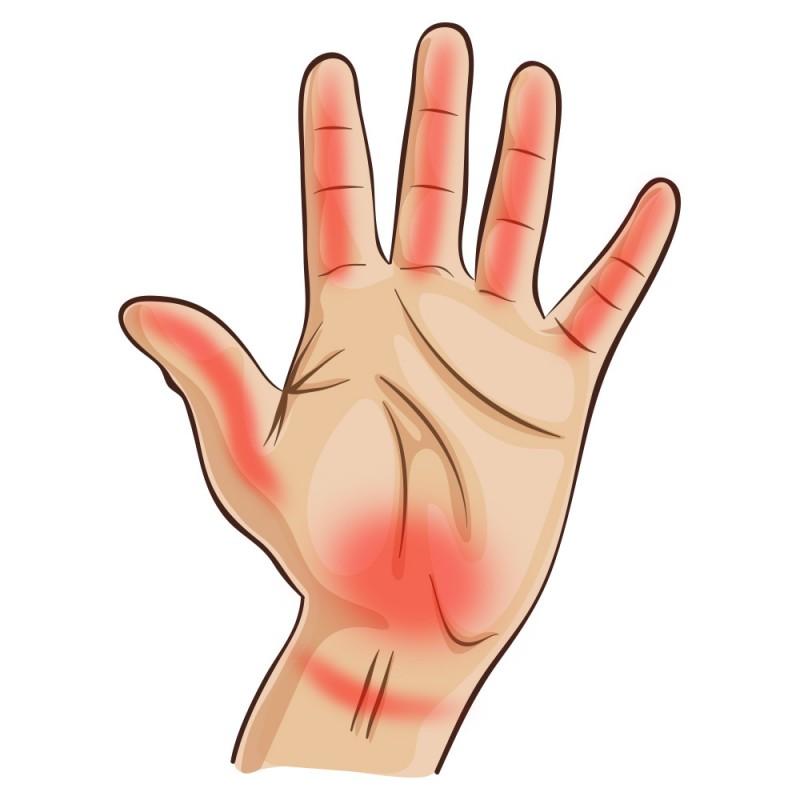 7 komoly betegség, amire a kézfejed figyelmeztet - Blikk Rúzs