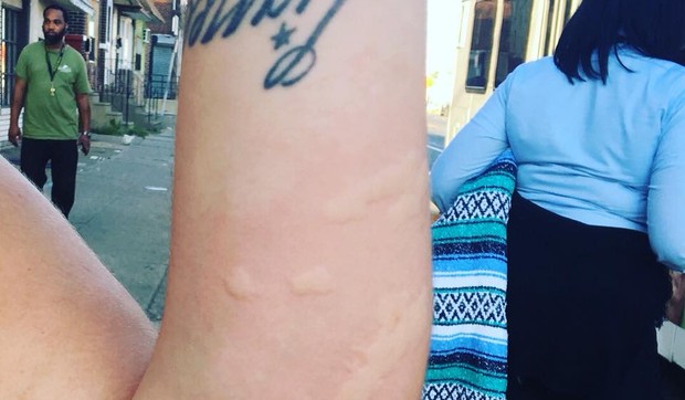 Kristal Lopez je objavila sliku ujeda na rukama