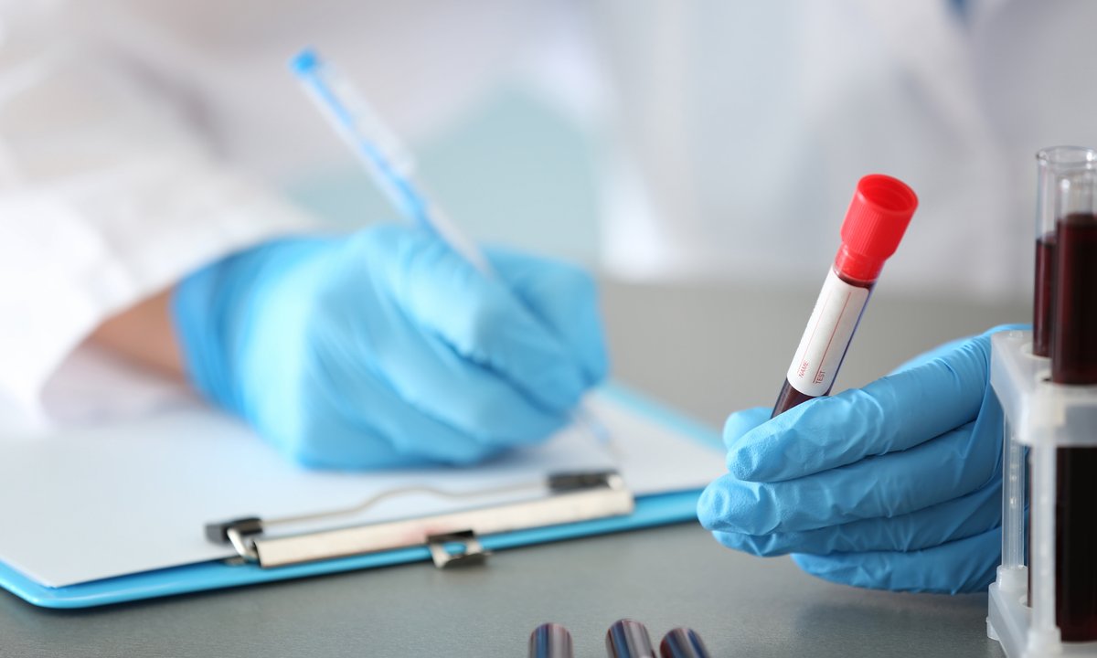 To najlepsza grupa krwi. Gwarantuje dłuższe życie — wynika z badań