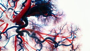 Sindrom curenja kapilara