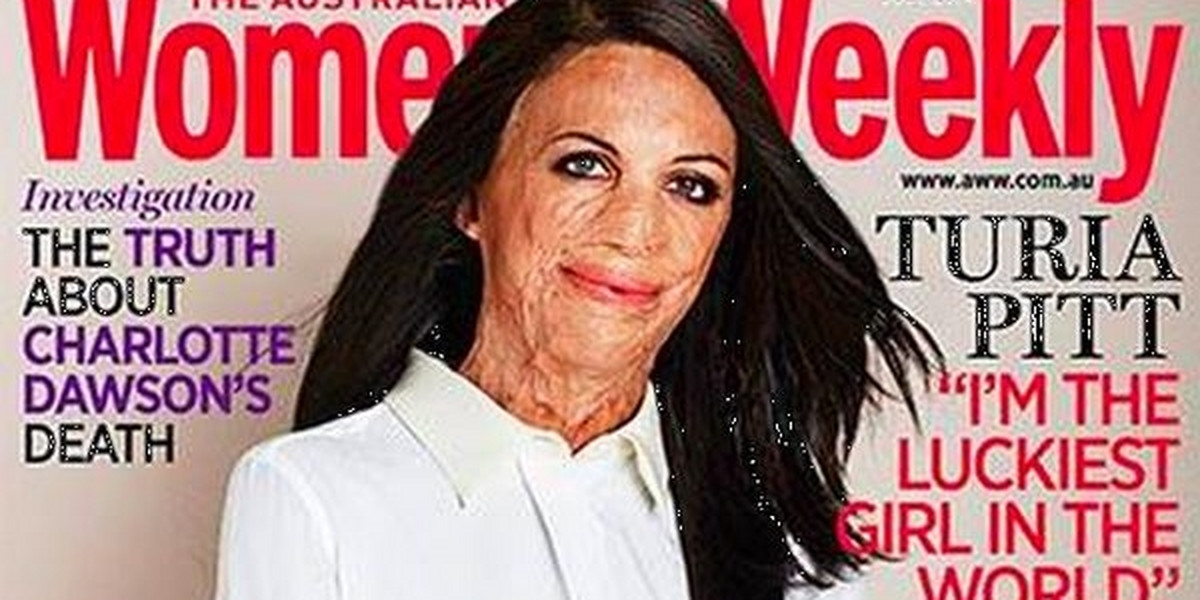 Turia Pitt na okładce "Women's Weekly" 