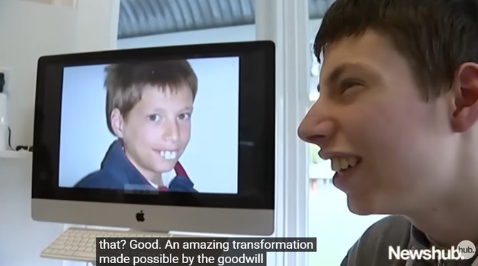 Evan Hil posle transformacije