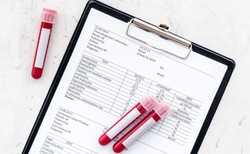 Jakie badania i kiedy/jak często powinien wykonywać każdy MĘŻCZYZNA? Sprawdź koniecznie!