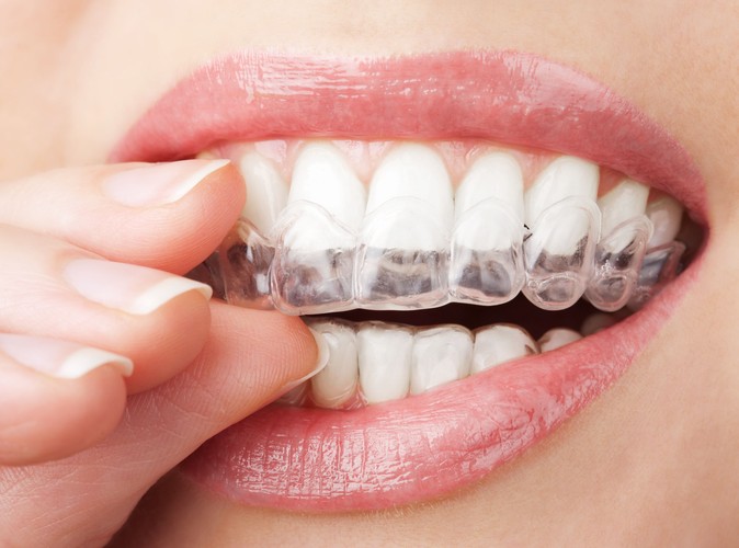 Jak wybielić zęby w domu?