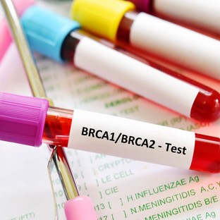 A vizsgálat, ami életeket menthet – Mit érdemes tudni a BRCA-tesztről?