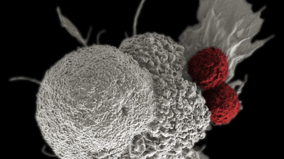 Limfocyty T (czerwone), atakujące komórkę nowotworową